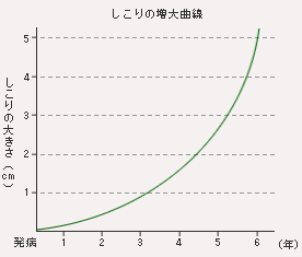 しこりの増大曲線